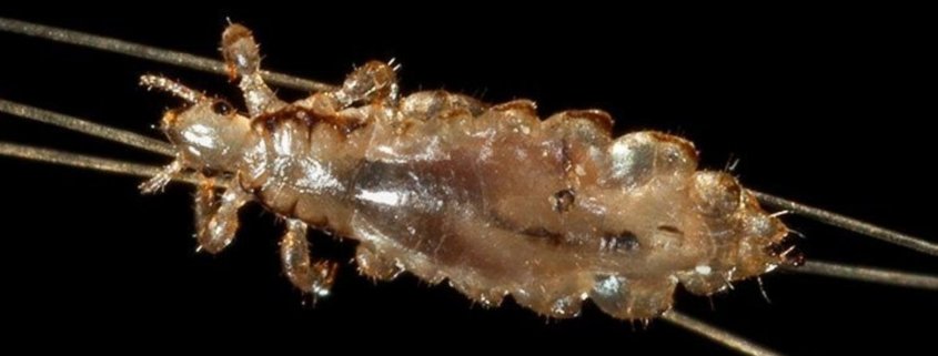Head Lice Myths You Shouldn't Believe
